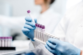 Un test salivaire de CBD